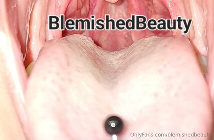 blemishedbeauty