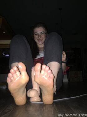 freckled_feet