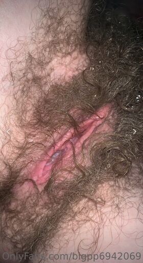 Hairy Women